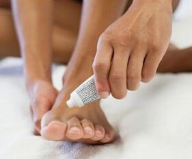 Fungal treatment