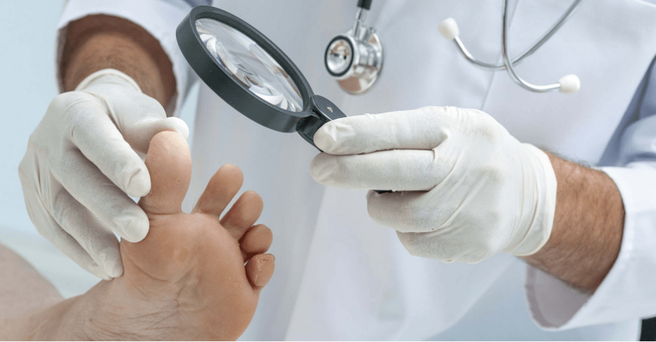 The first symptom of a fungus in the foot